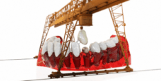 Dentures