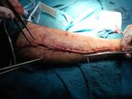 orthopedic surgery